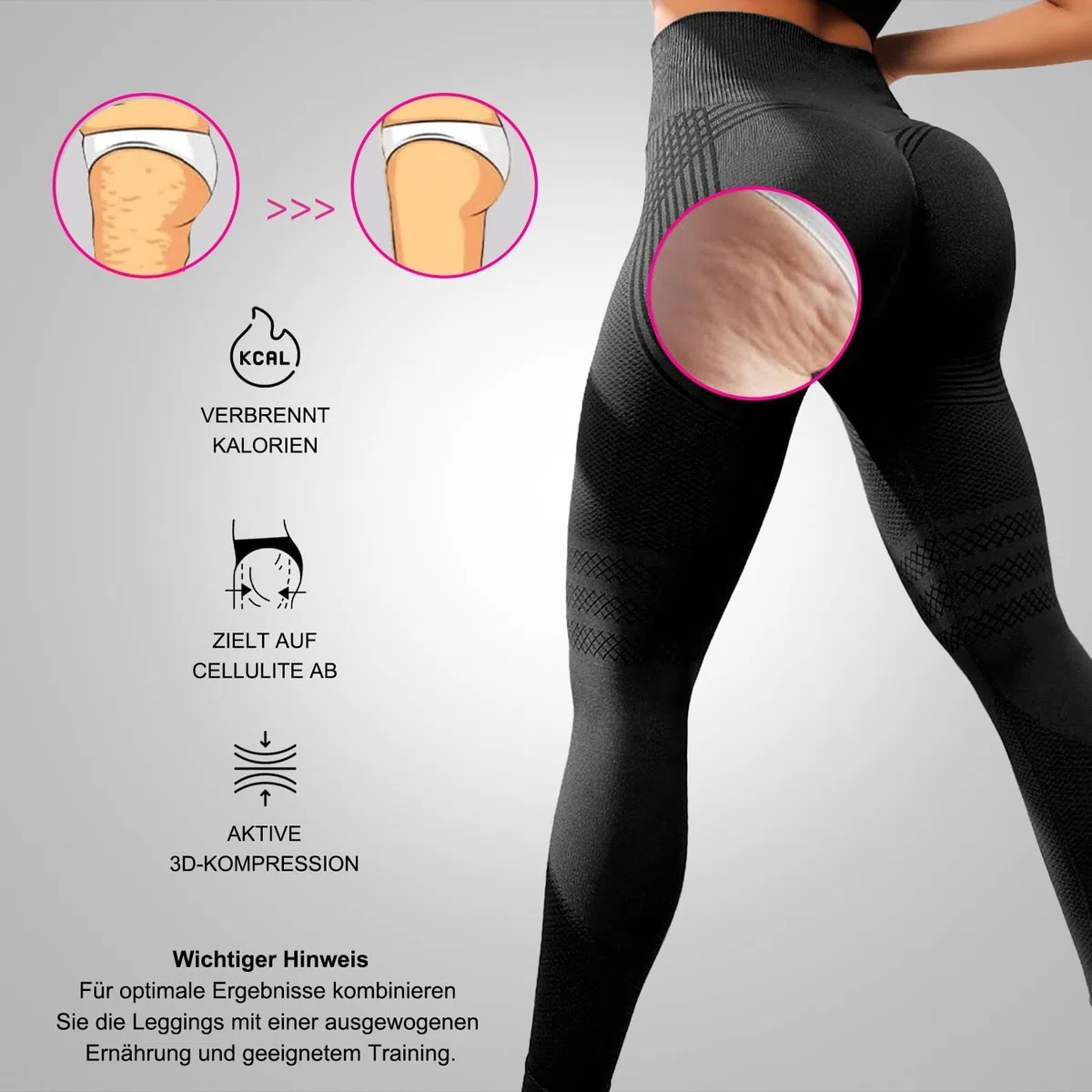 2 Pack Viva Cuerpo Leggings 3D Anticelulíticos Mujer,Leggings Anticelulitis 3D Compresión Lipedema,Leggins Anti Celulitis Deportivos Push Up, Mallas Anticelulitis Mujer Reductores Lipedema